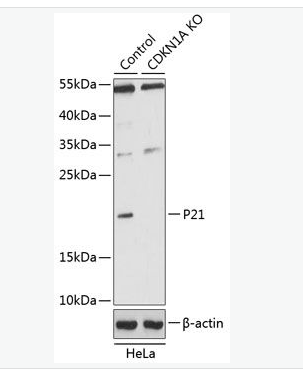 Anti-p21 antibody-p21蛋白抗体,p21