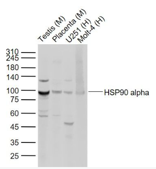 Anti-HSP90 alpha antibody-热休克蛋白90α抗体,HSP90 alpha