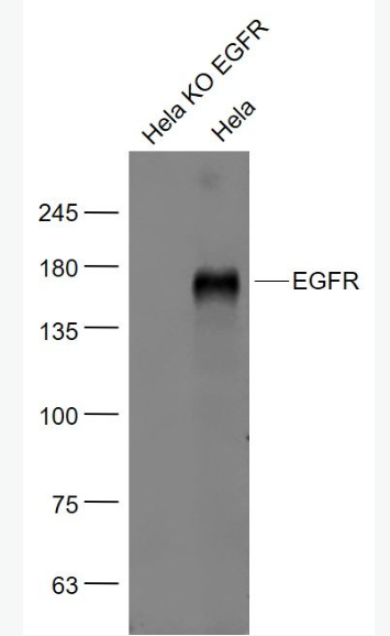 Anti-EGFR antibody-表皮生长因子受体单克隆抗体,EGFR