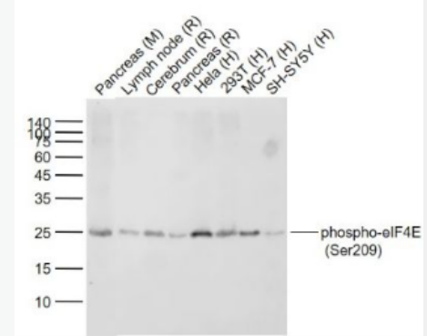 Anti-phospho-eIF4E (Ser209) antibody-磷酸化真核翻译起始因子4E重组兔单抗,phospho-eIF4E (Ser209)