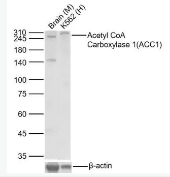 Anti-ACACAantibody-乙酰辅酶A羧化酶重组兔单抗,ACACA