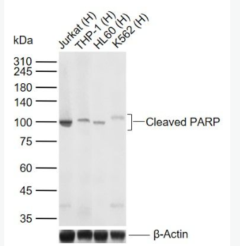 Anti-Cleaved PARP antibody-多腺苷二磷酸多聚酶/多聚ADP-核糖聚合酶1重组兔单抗,Cleaved PARP