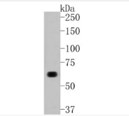 Anti-COL10A1 antibody-COL10A1重组兔单抗,COL10A1