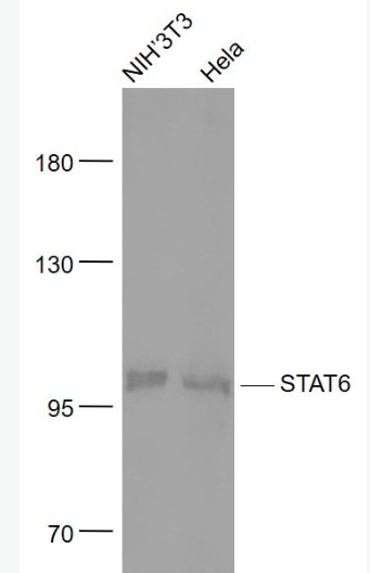Anti-STAT6 antibody-信号转导和转录激活因子6重组兔单抗,STAT6