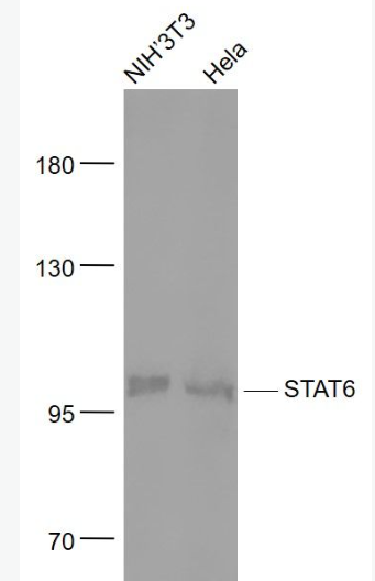 Anti-STAT6 antibody-信號轉(zhuǎn)導(dǎo)和轉(zhuǎn)錄激活因子6重組兔單抗,STAT6