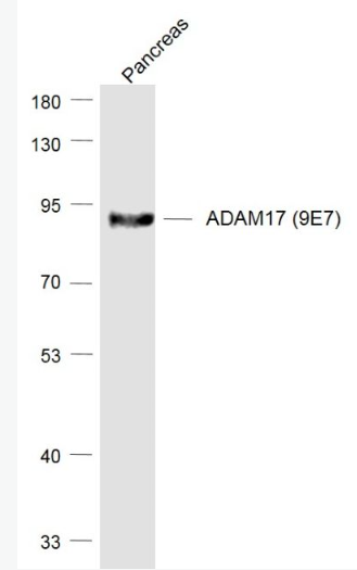 Anti-ADAM17 (9E7) antibody-ADAM17重组兔单抗,ADAM17 (9E7)