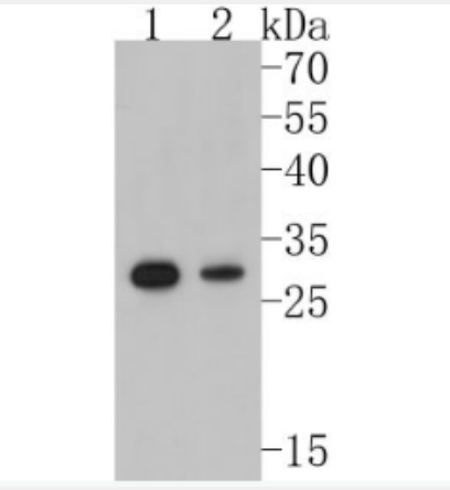 Anti-NQO1antibody-醌氧化还原酶重组兔单抗,NQO1