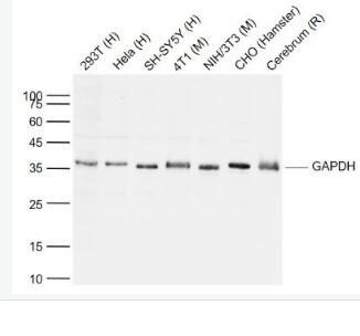 Anti-GAPDH antibody-3-磷酸甘油醛脫氫酶抗體,GAPDH