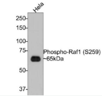 Anti-phospho-RAF1 (Ser259) antibody-磷酸化原癌基因RAF1重組兔單抗,phospho-RAF1 (Ser259)