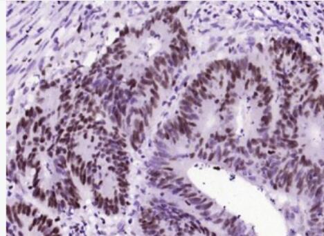 Anti-phospho-C-Myc (Ser62)antibody-磷酸化致癌基因C-Myc重组兔单抗,phospho-C-Myc (Ser62)