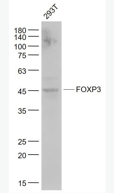 Anti-FOXP3 antibody-叉头蛋白P3重组兔单抗,FOXP3