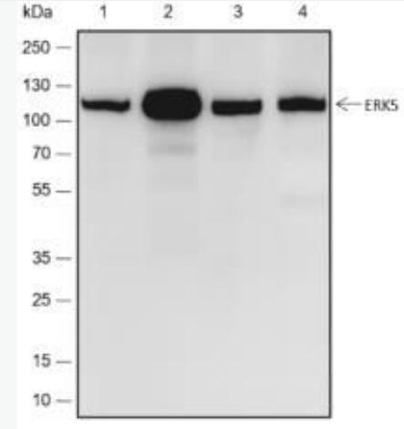 Anti-ERK5 antibody-细胞外信号调节激酶5重组兔单抗,ERK5