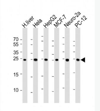 Anti-PSMA5 antibody-蛋白酶体PSMα5单克隆抗体,PSMA5