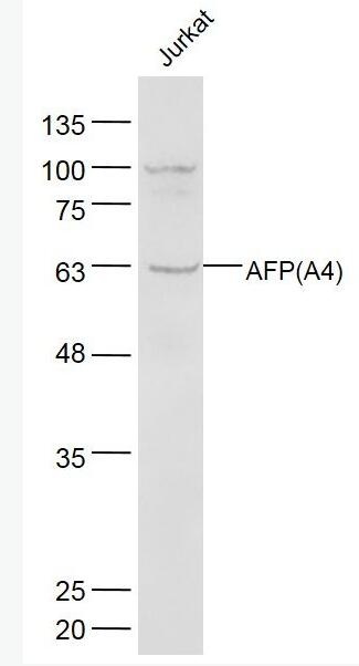 Anti-AFP(A4)   antibody-甲胎蛋白单克隆抗体(检测),AFP(A4)