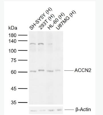 Anti-ACCN2 antibody-酸敏感离子通道1抗体,ACCN2