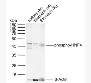 Anti-phospho-HNF4 (Ser313) antibody-磷酸化肝細(xì)胞核因子4α抗體,phospho-HNF4 (Ser313)