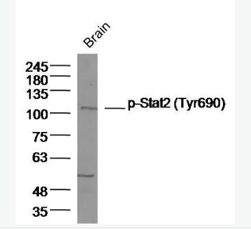 Anti-Phospho-Stat2 (Tyr690) antibody-磷酸化信号转导和转录激活因子2抗体,Phospho-Stat2 (Tyr690)