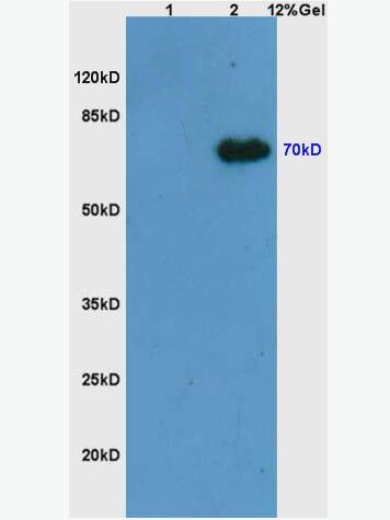 Anti-Phospho-Syk (Tyr525 + Tyr526) antibody-磷酸化非受體型酪氨酸蛋白激酶抗體,Phospho-Syk (Tyr525 + Tyr526)