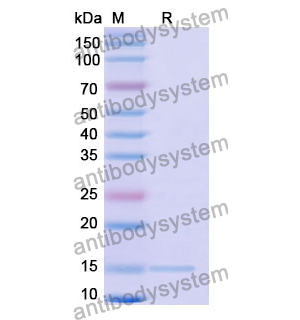 抗 Human DRD2 纳米抗体 (SAA1361)(RHD04802),Anti-Human DRD2 Nanobody (SAA1361)