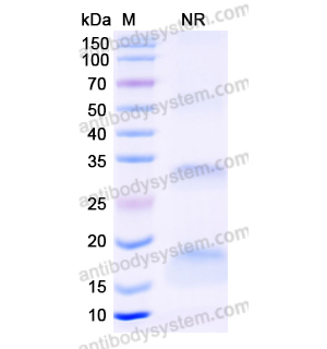 抗 Human B2M/Beta-2-microglobulin 纳米抗体 (SAA1047)(RHF46102),Anti-Human B2M/Beta-2-microglobulin Nanobody (SAA1047)