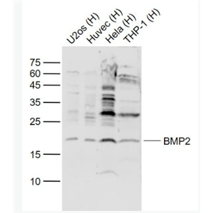 Anti-BMP2 antibody-骨形态发生蛋白2抗体