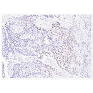 Anti-P63  antibody-腫瘤抑制基因p63α單克隆抗體