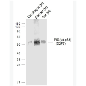 Anti-P53(wt-p53) (D2F7) antibody-肿瘤抑制基因野生型P53单克隆抗体