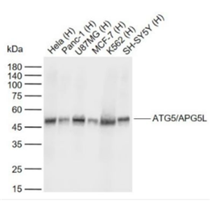 Anti-ATG5/APG5L antibody-自噬蛋白5单克隆抗体