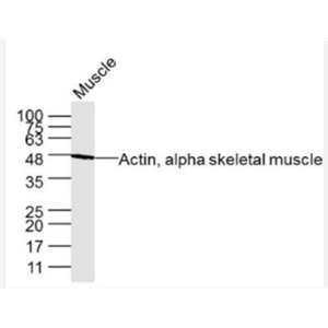 Anti-Actin, alpha skeletal muscle antibody-肌动蛋白α1单克隆抗体
