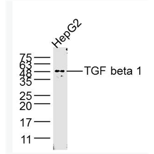 Anti-TGF beta 1 antibody-转化生长因子β1/TGF β1/TGF-β1单克隆抗体