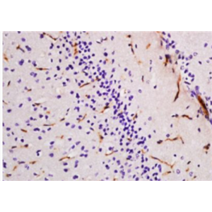 Anti-NGFB antibody-神经生长因子β单克隆抗体