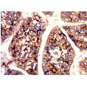 Anti-CEA(B5) antibody-癌胚抗原单克隆抗体（检测）
