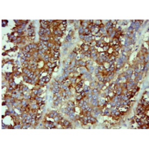Anti-CEA(C3) antibody-癌胚抗原单克隆抗体（包被）,CEA(C3)