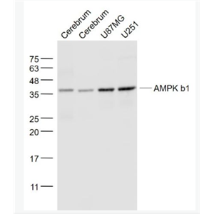 Anti-AMPK b1 antibody-腺苷单磷酸活化蛋白激酶β1单克隆抗体