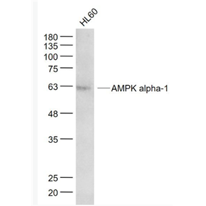 Anti-AMPK alpha-1 antibody-腺苷单磷酸活化蛋白激酶α1/AMPK α 1单克隆抗体,AMPK alpha-1