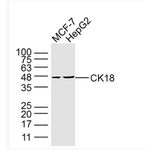 Anti-CK18  antibody-细胞角蛋白18单克隆抗体