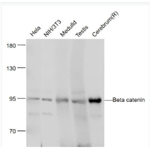Anti-Beta catenin antibody-β-连环蛋白/β-连环素/β链接素单克隆抗体.