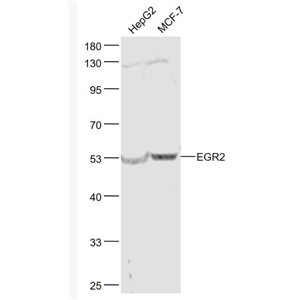 Anti-EGR2  antibody-早期生长反应蛋白2抗体