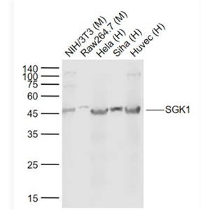 Anti-SGK1 antibody-糖皮质激素调节激酶1单克隆抗体