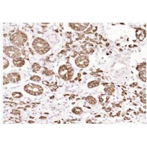 Anti-Pan Cytokeratin  antibody-广谱细胞角蛋白PCK单克隆抗体,Pan Cytokeratin