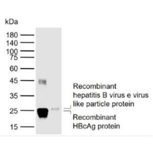 Anti-HBeAg  antibody-人乙型肝炎e抗原单克隆（包被）抗体,HBeAg