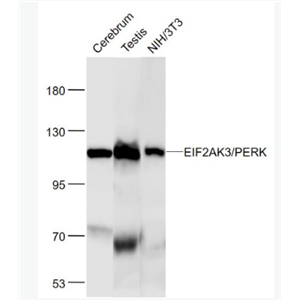 Anti-EIF2AK3/PERK  antibody-蛋白激酶样内质网激酶单克隆抗体