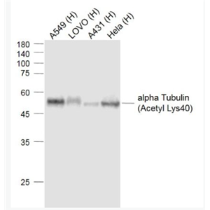 Anti-alpha Tubulin (Acetyl Lys40) antibody-乙酰化微管蛋白α/Tubulin α/α-tubulin单克隆抗体