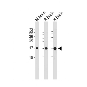 Anti-LC3  antibody-自噬微管相關(guān)蛋白輕鏈3單克隆抗體