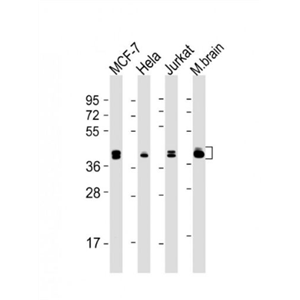 Anti-ERK1 antibody-丝裂原活化蛋白激酶1(MAPK3/1)单克隆抗体