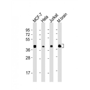 Anti-ERK1 antibody-絲裂原活化蛋白激酶1(MAPK3/1)單克隆抗體