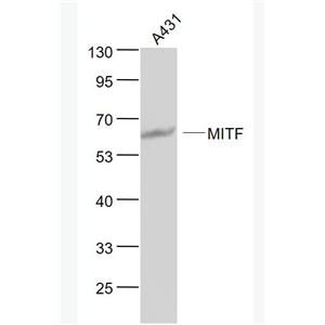 Anti-MITF antibody-微小细胞血症相关转录因子单克隆抗体