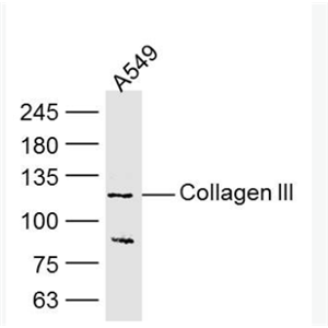 Anti-Collagen III antibody-III型胶原单克隆抗体