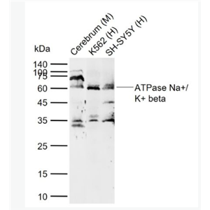 Anti-ATPase Na+/ K+ beta 2antibody-钠钾ATP酶通道蛋白抗体