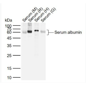 Anti-Human Serum albumin (Loading Control) antibody-白蛋白（内参）抗体